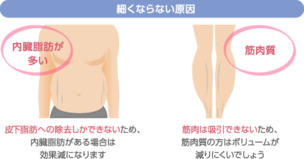 細くならない原因　内臓脂肪が多い：内臓脂肪までカニューレが到達すると、心臓などに悪影響があり修復不可能に　筋肉質：筋肉にアプローチすると、収縮して筋肉のラインがくっきり浮き出てしまいます