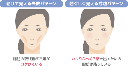 老けて見える失敗パターン：脂肪の取り過ぎで頬がコケけている　若々しく見える成功パターン：ハリやふっくら感を出すための脂肪は残っている