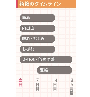 脂肪吸引のダウンタイム