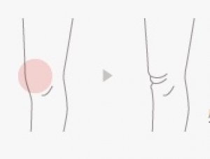 膝、たるみ