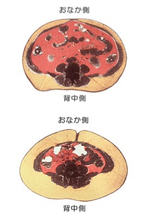 内臓脂肪 皮下脂肪