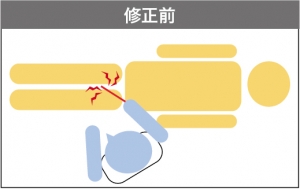 脂肪吸引 失敗 原因