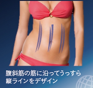 アブクラックス 縦割れ腹筋 脂肪吸引