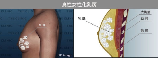 女性化乳房 真性 乳腺