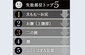 脂肪吸引 失敗 ランキング