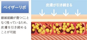 ベイザーリポの性能